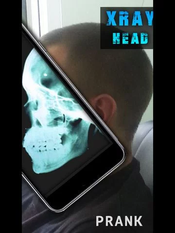 Изображение игры: Simulator X-Ray Head