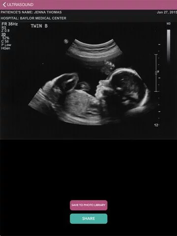 Изображение игры: Ultrasound Spoof 2016: Pregnancy Test