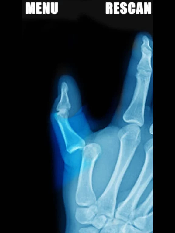 Изображение игры: Simulator X-Ray - Finger Prank