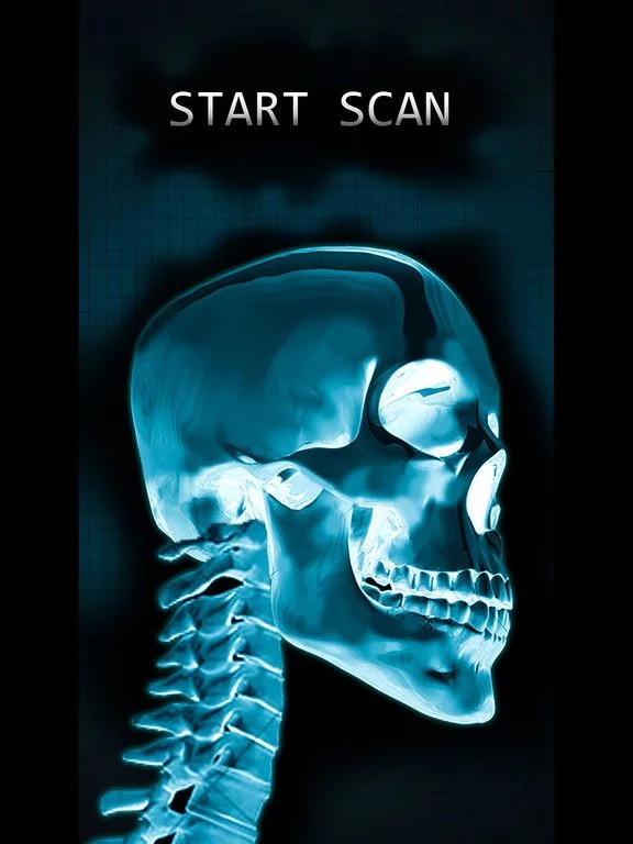 Изображение игры: Simulator X-Ray Bone Fake
