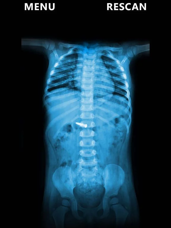 Изображение игры: X-Ray Scanner Body Prank